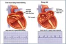 Nhiều đột phá trong ứng dụng điều trị các bệnh tim mạch