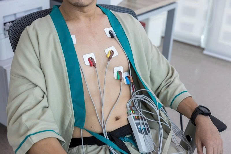 Dien Cuc ECG